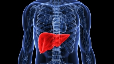 Liver cancer: Risk factors for rise in India's Hepatocellular Carcinoma cases (Photo by Twitter/AHealthyBod) Liver cancer: Risk factors for rise in India's Hepatocellular Carcinoma cases (Photo by Twitter/AHealthyBod)