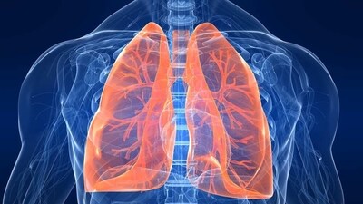 Tips to organically cure lung illness due to air pollution (Photo by Twitter/theoliveranwar) Tips to organically cure lung illness due to air pollution (Photo by Twitter/theoliveranwar)