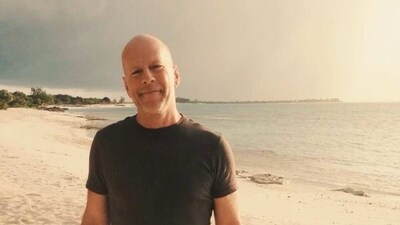 Bruce Willis has been diagnosed with frontotemporal dementia, according to a joint statement released by his family. Bruce Willis has been diagnosed with frontotemporal dementia, according to a joint statement released by his family.