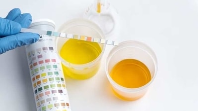 A dark yellow colour usually means you are dehydrated while a reddish urine could indicate cancer. (Freepik) A dark yellow colour usually means you are dehydrated while a reddish urine could indicate cancer. (Freepik)
