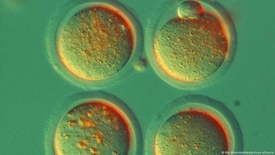 Mouse cells used for stem cell research at the Max Planck Institute for Molecular Biomedicine, where researchers are looking into stem cell therapies. (Mpi Muenster/dpa/picture alliance) Mouse cells used for stem cell research at the Max Planck Institute for Molecular Biomedicine, where researchers are looking into stem cell therapies. (Mpi Muenster/dpa/picture alliance)