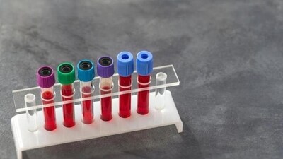 Circovirus involved in human hepatitis: Study (Shutterstock)