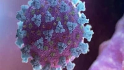Covid cannot lead to any autoimmune disease directly, however, like many other viral illnesses, Covid can certainly harm in two ways as far as autoimmune disease is concerned. (REUTERS) Covid cannot lead to any autoimmune disease directly, however, like many other viral illnesses, Covid can certainly harm in two ways as far as autoimmune disease is concerned. (REUTERS)