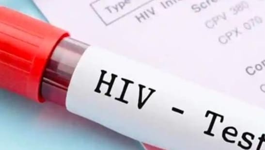 9. HIV/AIDS: HIV/AIDS is a viral infection caused by the human immunodeficiency virus (HIV). It is spread through contact with infected body fluids. Symptoms of HIV/AIDS include fever, fatigue, weight loss, and opportunistic infections. Treatment for HIV/AIDS includes antiretroviral medications and lifestyle changes.