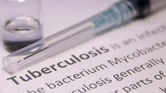 2. Tuberculosis: Tuberculosis (TB) is an infectious disease caused by the Mycobacterium tuberculosis bacteria. It is spread through the air when an infected person coughs, sneezes, or speaks. Symptoms of TB include coughing, fever, night sweats, and weight loss. Treatment for TB involves a combination of antibiotics.(Unsplash)