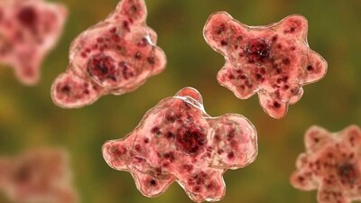 'Brain-eating' amoeba destroys brain tissues. (File) 'Brain-eating' amoeba destroys brain tissues. (File)