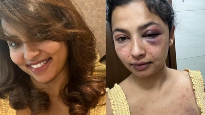 Anicka Vikhraman accuses former boyfriend Anoop Pillai of physical and mental abuse. Anicka Vikhraman accuses former boyfriend Anoop Pillai of physical and mental abuse.