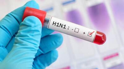 Influenza-like illness is a nonspecific respiratory illness characterized by fever, fatigue, cough, and other symptoms (Representative Photo) Influenza-like illness is a nonspecific respiratory illness characterized by fever, fatigue, cough, and other symptoms (Representative Photo)