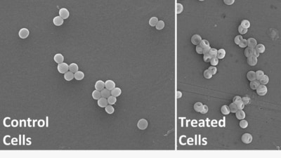 IIT Roorkee says this molecule could help in the fight against drug-resistant infections IIT Roorkee says this molecule could help in the fight against drug-resistant infections