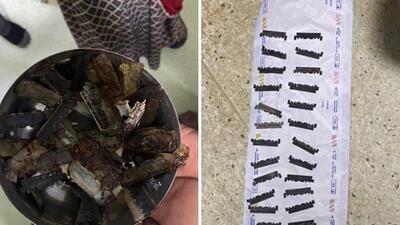 The man was brought to the hospital on Monday after he started vomiting blood, which indicated internal bleeding. (Photo: Sourced)