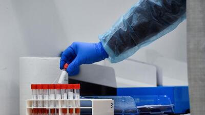 A healthcare worker places a vial with a swab of the coronavirus disease (COVID-19) test along with other vials, after Italy has ordered COVID-19 antigen swabs and virus sequencing for all travellers coming from China, where cases are surging, at the Malpensa Airport in Milan, Italy, December 29, 2022. REUTERS/Jennifer Lorenzini (REUTERS) A healthcare worker places a vial with a swab of the coronavirus disease (COVID-19) test along with other vials, after Italy has ordered COVID-19 antigen swabs and virus sequencing for all travellers coming from China, where cases are surging, at the Malpensa Airport in Milan, Italy, December 29, 2022. REUTERS/Jennifer Lorenzini (REUTERS)