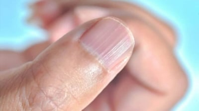 Incorporating these simple tips into your daily routine can help strengthen your nails and promote healthy growth. By staying hydrated, avoiding harsh chemicals, incorporating vitamins and minerals, avoiding biting or picking, filing properly, and moisturizing regularly, you can keep your nails looking strong and healthy. (Instagram/Dr Nitika Kohli) Incorporating these simple tips into your daily routine can help strengthen your nails and promote healthy growth. By staying hydrated, avoiding harsh chemicals, incorporating vitamins and minerals, avoiding biting or picking, filing properly, and moisturizing regularly, you can keep your nails looking strong and healthy. (Instagram/Dr Nitika Kohli)