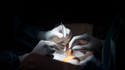 Maharashtra government will appoint an inquiry committee headed by a retired High Court judge to probe the kidney racket at Ruby Hall Clinic, said health minister Tanaji Sawant on Friday. (AFP (PIC FOR REPRESENTATION))