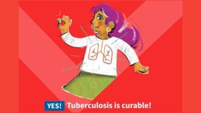 World Tuberculosis Day: Phases of TB and tips by health expert to avoid it (Photo by Twitter/aamirchmd) World Tuberculosis Day: Phases of TB and tips by health expert to avoid it (Photo by Twitter/aamirchmd)