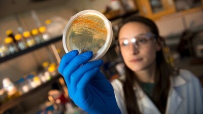 The model, created by scientists at University of California San Francisco (UCSF), US, is poised to reignite interest in the science of smell. (Representational Image) (AFP) The model, created by scientists at University of California San Francisco (UCSF), US, is poised to reignite interest in the science of smell. (Representational Image) (AFP)