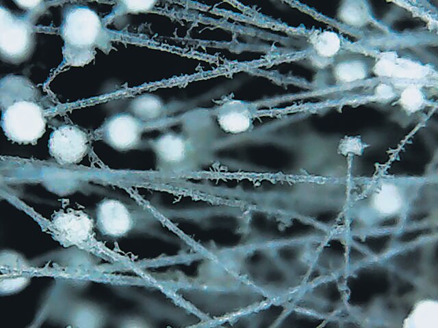 Bread mold under a USB microscope, in an image by Purva Variyar. Bread mold under a USB microscope, in an image by Purva Variyar.