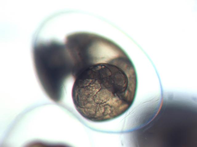 A live pond-snail embryo still inside its egg, in an image by Purva Variyar. A live pond-snail embryo still inside its egg, in an image by Purva Variyar.