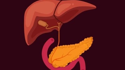 Vitamin-A rich diet can cut down risk of Pancreatitis (Shutterstock) Vitamin-A rich diet can cut down risk of Pancreatitis (Shutterstock)