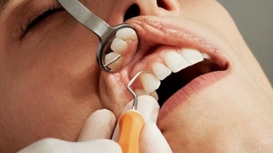 Don’t forget to visit your dentist: It is advised to visit a dentist frequently for proper and thorough cleaning. A dentist can not only remove tartar and plaque that cannot be removed with a toothbrush but, can also spot early signs of tooth-related diseases