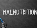 Medical Concept: Black Chalkboard with Malnutrition. Medical Concept: Malnutrition Handwritten on Black Chalkboard. Top View of Blue Stethoscope on Chalkboard. 3D Rendering. (tashatuvango - Fotolia)