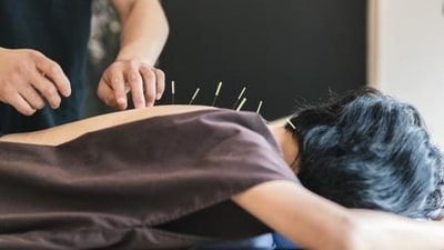 Acupuncture: Acupuncture may help regulate menstrual cycles by improving blood flow and reducing stress. (File Photo (Shutterstock)) Acupuncture: Acupuncture may help regulate menstrual cycles by improving blood flow and reducing stress. (File Photo (Shutterstock))