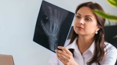 Being physically active and involving oneself in activities like running, cycling and walking can also help deterioration of bone health as one grows old. (Freepik) Being physically active and involving oneself in activities like running, cycling and walking can also help deterioration of bone health as one grows old. (Freepik)