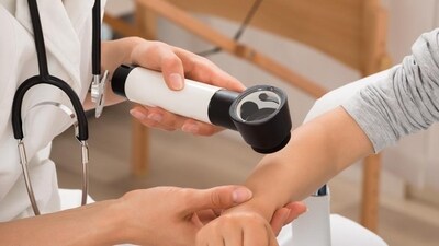 Melanoma is the deadliest form of skin cancer. (Shutterstock) Melanoma is the deadliest form of skin cancer. (Shutterstock)