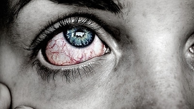 Thyroid eye disease: People suffering from this eye disorder may feel colours do not appear as bright as before, (Pixabay) Thyroid eye disease: People suffering from this eye disorder may feel colours do not appear as bright as before, (Pixabay)