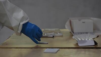 Chandigarh has recorded 99,513 Covid cases till date. Of the total patients, 98,235 have recovered and 1,183 have died. (HT File Photo)