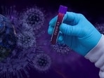 The technology will be used to identify all viral, bacterial and fungal species through DNA sequencing technique.