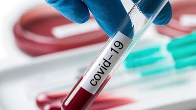 The total number of recovered Covid-19 cases in Manipur is 1,37,775 (Representative Photo)