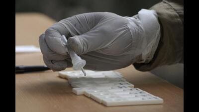The fresh cases in Chandigarh surfaced in Sectors 7, 15, 18, 20, 22, 23, 25, 26, 27, 29, 32, 34, 36, 40, 41 and 42, Daria, Dhanas, Kaimbwala and PGIMER campus. (iStock) The fresh cases in Chandigarh surfaced in Sectors 7, 15, 18, 20, 22, 23, 25, 26, 27, 29, 32, 34, 36, 40, 41 and 42, Daria, Dhanas, Kaimbwala and PGIMER campus. (iStock)