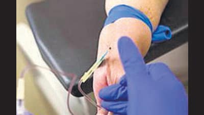 The State Blood Transfusion Council (SBTC) has instructed all blood banks to notify new and old hepatitis B and C patients reported at blood banks in an effort to eradicate the diseases (REPRESENTATIVE IMAGE)