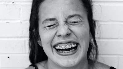 Braces are a common orthodontic treatment, but there are many myths surrounding them that can be confusing or even discouraging for those considering braces. (Unplash ) Braces are a common orthodontic treatment, but there are many myths surrounding them that can be confusing or even discouraging for those considering braces. (Unplash )
