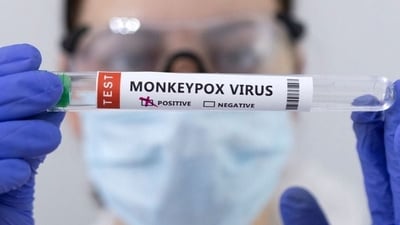 South Korea Monkeypox: Swab samples for monkeypox being tested. (Reuters)