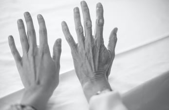 Anti-ageing alert: Watch out for these 8 factors causing you wrinkles before age (Photo by Malin K. on Unsplash) Anti-ageing alert: Watch out for these 8 factors causing you wrinkles before age (Photo by Malin K. on Unsplash)