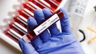The health minister has asked the health department to ramp up Covid testing. (HT photo) The health minister has asked the health department to ramp up Covid testing. (HT photo)