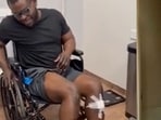 Moses Gibson increased his height from 5 feet 5 inches to 5 feet 8 inches after undergoing a procedure in 2016. Moses Gibson increased his height from 5 feet 5 inches to 5 feet 8 inches after undergoing a procedure in 2016.