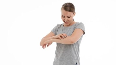 People can also develop hives, when you are in sun or if one takes certain medications or have a sun sensitivity. You may experience red, scaly and extremely itchy bumps, and even blisters. You may be having medications that can cause an allergic sun reaction. Stay out of the sun in such cases. (Pixabay) People can also develop hives, when you are in sun or if one takes certain medications or have a sun sensitivity. You may experience red, scaly and extremely itchy bumps, and even blisters. You may be having medications that can cause an allergic sun reaction. Stay out of the sun in such cases. (Pixabay)