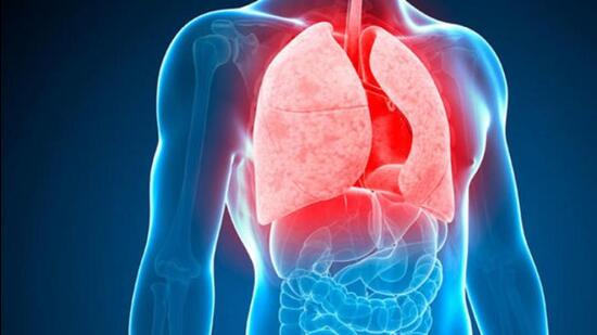 BMC to start DR-TB centre in private hospitals