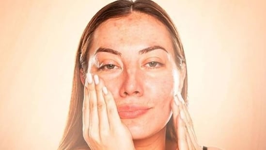 Keep your hands off your face: While it's tempting to touch our face throughout the day, doing so can transfer bacteria and oils from our hands onto our skin, clogging pores and causing breakouts. Try to avoid touching your face and use blotting papers instead.(Instagram)