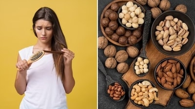 Hair loss many a times is a result of nutritional deficiency and can be controlled by adding the right foods to your diet (Freepik) Hair loss many a times is a result of nutritional deficiency and can be controlled by adding the right foods to your diet (Freepik)