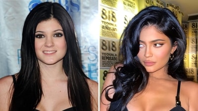 Kylie Jenner said that its a 'misconception' that she has had plastic surgery. Kylie Jenner said that its a 'misconception' that she has had plastic surgery.