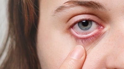 Extreme summer has arrived early in most parts of the country as dangerously high temperatures have been recorded in many states like West Bengal, Bihar and Andhra Pradesh. Extreme heat can take a toll on your eye health too with redness, itchiness and burning sensation becoming more common. Dr. Rishi Raj Borah, Country Director - India, Orbis shares tips to take care of your eyes in extreme heat. (Freepik) Extreme summer has arrived early in most parts of the country as dangerously high temperatures have been recorded in many states like West Bengal, Bihar and Andhra Pradesh. Extreme heat can take a toll on your eye health too with redness, itchiness and burning sensation becoming more common. Dr. Rishi Raj Borah, Country Director - India, Orbis shares tips to take care of your eyes in extreme heat. (Freepik)