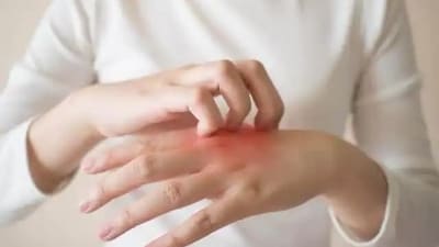 Wearing sweater to sleep increases dryness of skin. This leads to eczema and other skin problems. Wearing sweater to sleep increases dryness of skin. This leads to eczema and other skin problems.