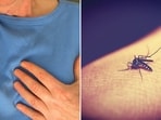 Malaria is a protozoan disease which spreads by the bite of infected female anopheles mosquitoes. 