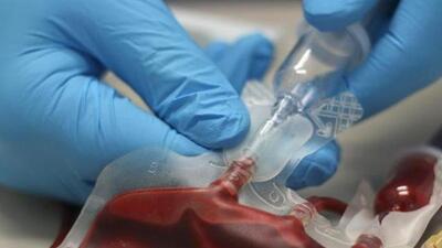 Dr Nagnath Yempalay, district civil surgeon, said we will issue a reminder letter to all the hospitals in which the blood storage centres are located. (REPRESENTATIVE PHOTO) Dr Nagnath Yempalay, district civil surgeon, said we will issue a reminder letter to all the hospitals in which the blood storage centres are located. (REPRESENTATIVE PHOTO)
