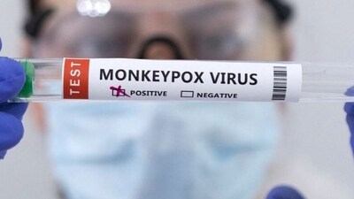 Swab samples for monkeypox being tested. Swab samples for monkeypox being tested.