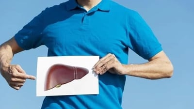 "Your liver is responsible for over 500 functions in the body. This makes it essential for us to build a healthy and clean liver. Whether it's fatty liver, thyroid imbalances, stubborn fat, or skin and hair issues, your liver is responsible. When your liver functions are compromised, these can be stalled too," says Luke Coutinho, Holistic Nutrition and Lifestyle – Integrative and Lifestyle Medicine, Founder of You Care - All about YOU. (Getty Images/iStockphoto) "Your liver is responsible for over 500 functions in the body. This makes it essential for us to build a healthy and clean liver. Whether it's fatty liver, thyroid imbalances, stubborn fat, or skin and hair issues, your liver is responsible. When your liver functions are compromised, these can be stalled too," says Luke Coutinho, Holistic Nutrition and Lifestyle – Integrative and Lifestyle Medicine, Founder of You Care - All about YOU. (Getty Images/iStockphoto)