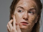 coffee_for_skin